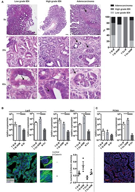 Frontiers Increased Incidence Of Colon Tumors In AOM Treated Apc1638N