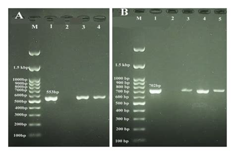 Touchdown Pcr Assay For The Detection Of Listeria Spp A And L