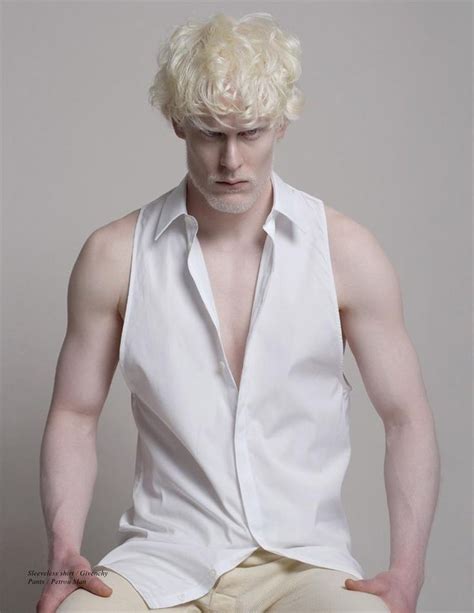 Stephen Thompson For Whiteout Jul 11 Albino Model Albino Men Albinism