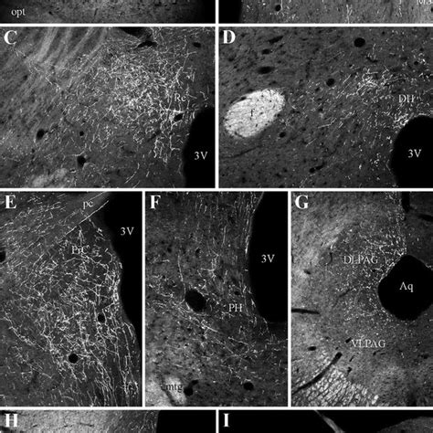 Projections From The IHy Darkfield Photomicrographs Showing The