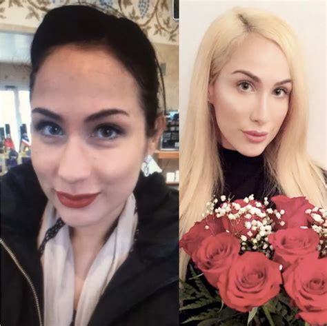 Pay Woman Spends 15k Dollars On Plastic Surgery To Look Like Bella