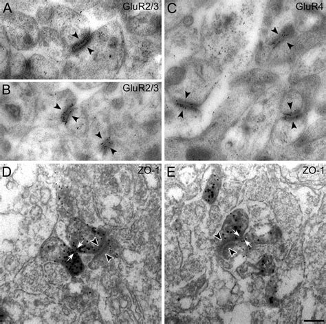 Electron Micrographs Of Vertical Sections Through The Synaptic Complex