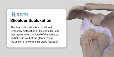 Shoulder Subluxation - NJ's Top Orthopedic Spine & Pain Management Center