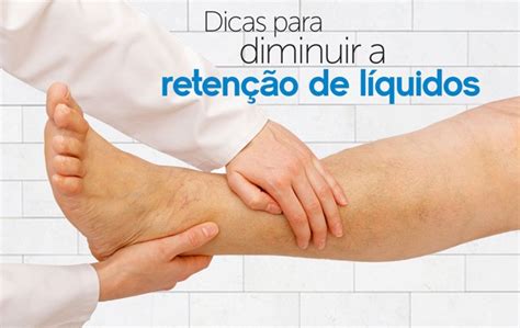 Reten O De Liquido Como Ocorre Como Evitar