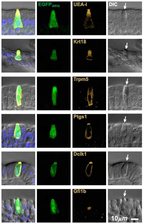 Ptgs1 Mgi Mouse Gene Detail Mgi97797 Prostaglandin Endoperoxide