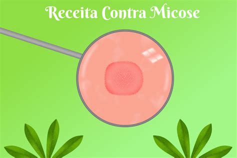 Receita Contra Micose Chá de Folha de Mandioca Terapia Verde