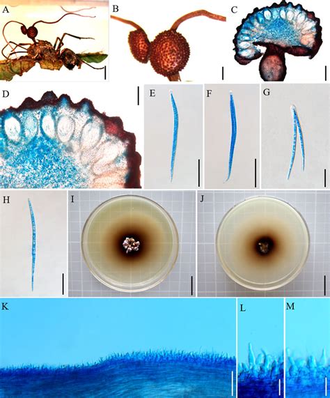 Ophiocordyceps Bifertilis A Infected Polyrhachis Sp 1was Biting A Download Scientific Diagram