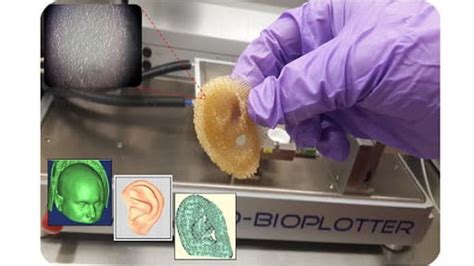 Printing organs with 3D Printers: Benefits and challenges - 3D MOTIFS