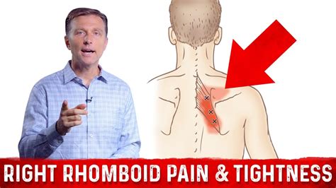 Chronic Right Rhomboid Muscle Pain Tightness Trigger Points Dr