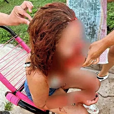 Una joven denunció que fue brutalmente atacada durante una fiesta