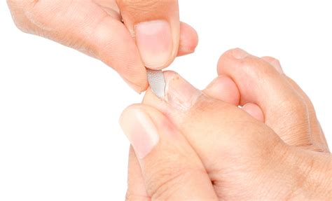 Ongle Incarn Causes Solutions Et Pr Vention Sant Pied