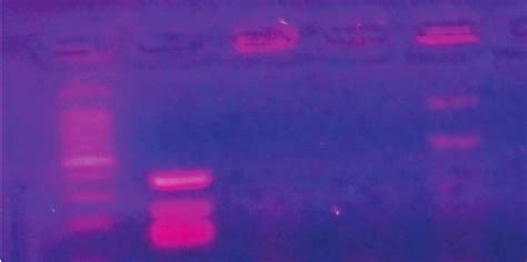 Plasmid Profile Of Bacteriocin And Proteinase Producing L Lactis Download Scientific Diagram