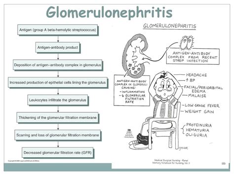 Glomerulonephritis Nurses Revision