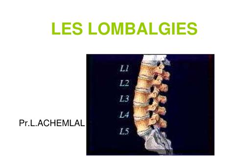 Lom Rhumatologie Lombalgies Les Lombalgiesles Lombalgiesles