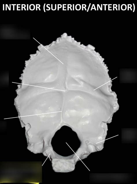 Occipital Bone Diagram Quizlet