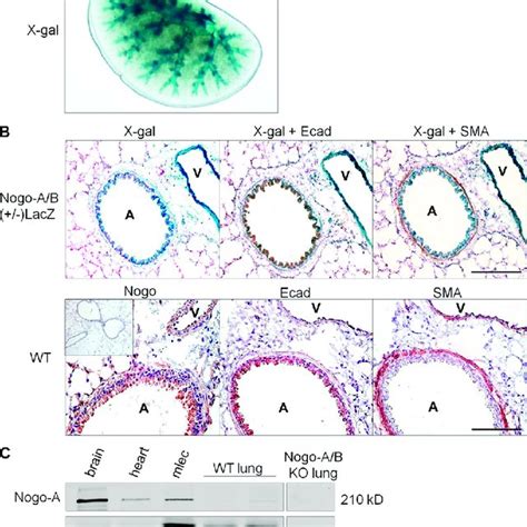 Nogo B Is Highly Expressed In The Lung A Whole Mount X Gal Staining