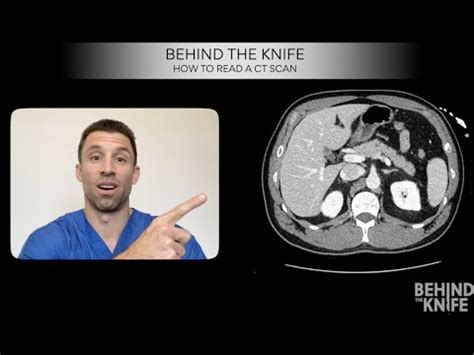 Behind The Knife How To Read A CT Scan YouTube