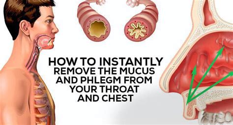 How To Remove Mucus And Phlegm From The Throat And Chest My Healthygram