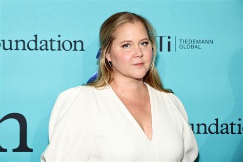 Amy Schumer Says That Internet Trolling Led To Cushing Syndrome