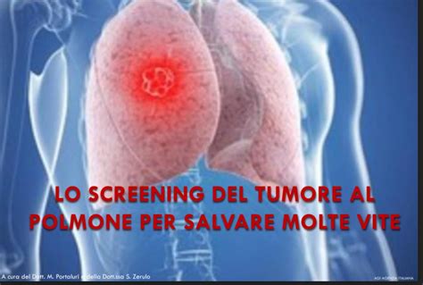 Prevenzione Secondaria Tumore Al Polmone InfoNurse