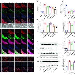 Ct Reduced Oxidative Stress Induced Mitochondrial Damage In Carotid