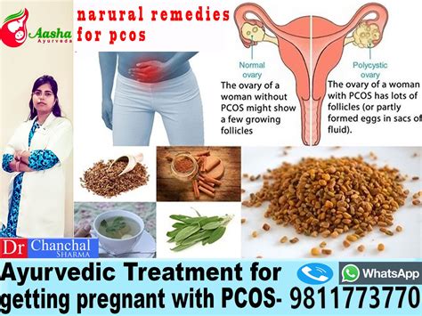 Cure Pcos Naturally