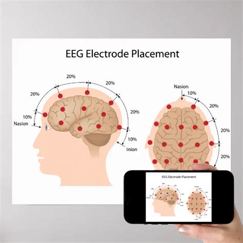 Eeg Electrode Placement Diagram Poster Zazzle
