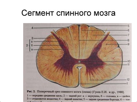 Сирингомиелия. Сегментарно-диссоциированныйтип расстройства ...