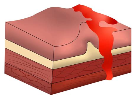 Ebook Gastroenterolog A Enam By Qxmedic Issuu