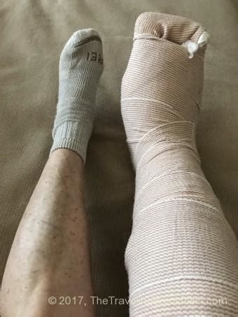 Bandaging after foot surgery | Sandra Bornstein