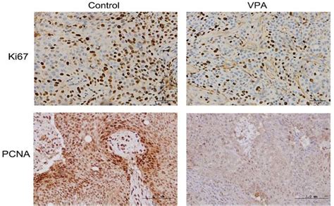 Immunohistochemistry For Ki67 And PCNA In Xenograft Tumors In Vivo