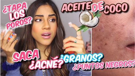 Elimina Los Granos De Tu Piel Con El Poder Del Aceite De Coco Facial