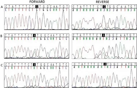 The Forward And Reverse Sequence Chromatograms Of The C A G