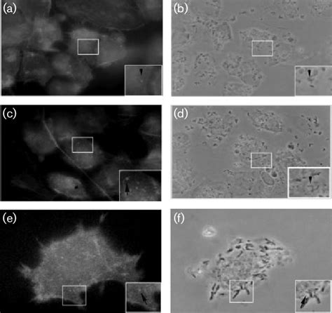 Fluorescence And Phase Contrast Microscopy Shows Positive Fas Tests Of