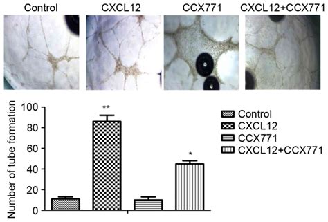 CXCR7 Regulates Breast Tumor Metastasis And Angiogenesis In Vivo And In