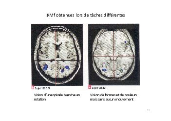 Rappels Neurone Et Fibre Musculaire La Communication Nerveuse