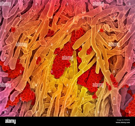 Streptomyces Coelicoflavus Bacterias Color An Lisis Micrograf A De