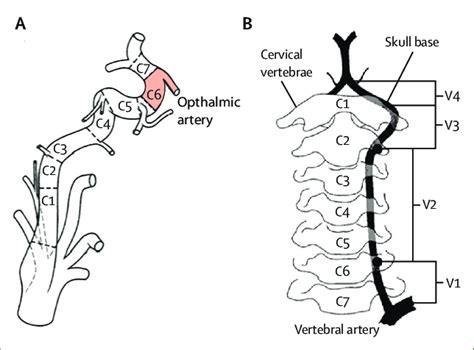 Cervical Carotid Artery Anatomy