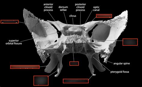 Sphenoid Bone Posterior Diagram Quizlet