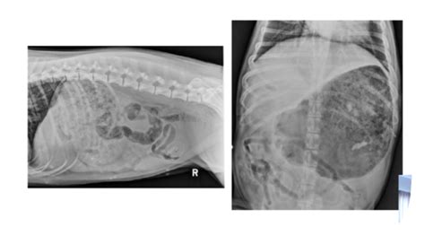 Abdominal Radiographs Flashcards Quizlet