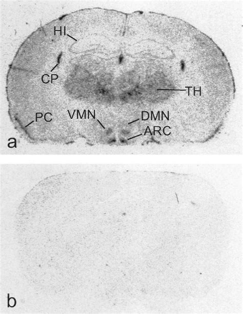 Structure of paraventricular nucleus | Semantic Scholar