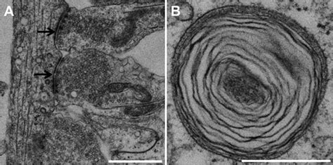 Transmission Electron Microscopy Images A Showing Synapse Formation