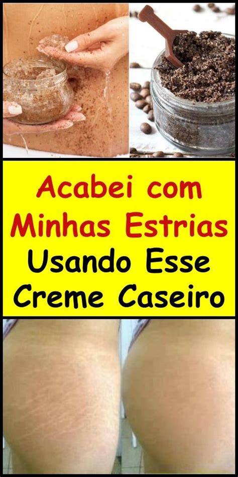 Como Fazer Creme Anti Estrias Caseiro Rem Dio Para Estrias Creme