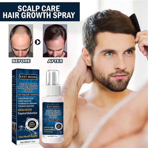 Hair Growth Serum 6 Minoxidil Spray Anti Hair Loss Men Hair Sideburns Prevent Receding Hairline