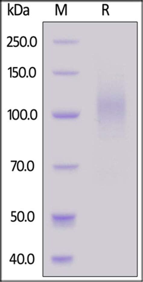 Acrobiosystems Acrobiosystems Biotinylated Sars Cov Spike S T I