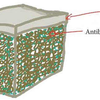 Schematic Drawing Of The Antibiotic Loaded Bone Cement Procedure A