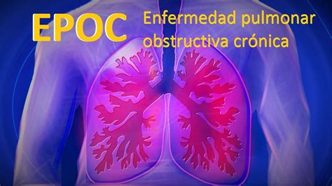 EPOC La enfermedad pulmonar obstructiva crónica Epoc síntomas consejos