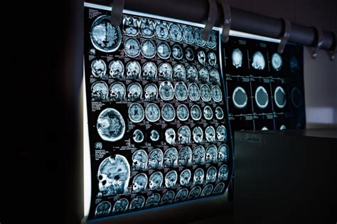 3T MRI, MRI, or CT Scan: How to Determine the Best Imaging Option for Your Diagnosis - Houston ...