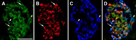 Triple Immunofluorescence Photomicrographs Of Sections Of Human