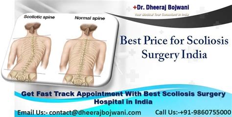 Affordable Scoliosis Surgery In India In Assistance With Best Scoliosis